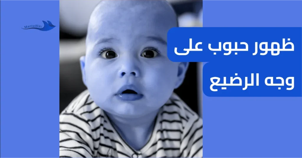 ظهور حبوب على وجه الرضيع