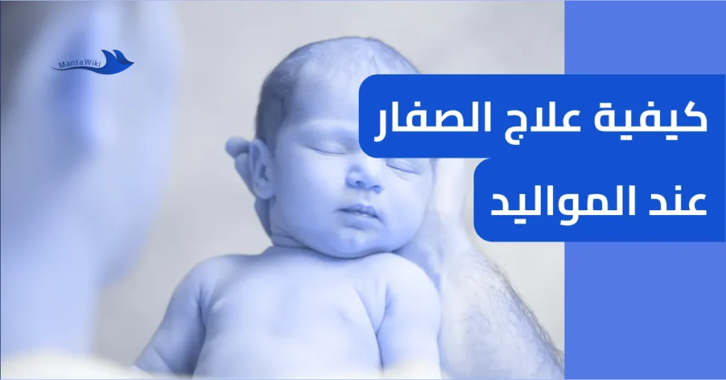 كيفية علاج الصفار عند المواليد